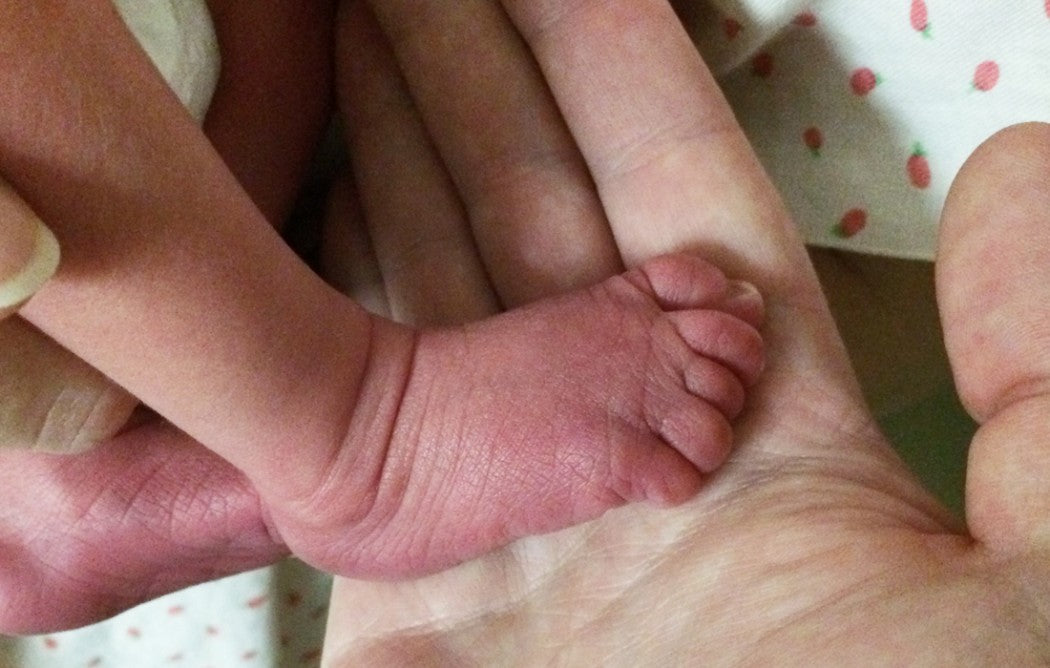 Emmit's Birth Story